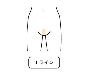 Iライン