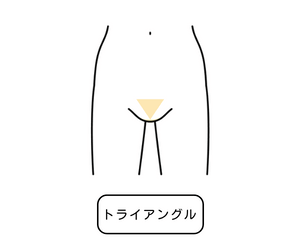 トライアングル