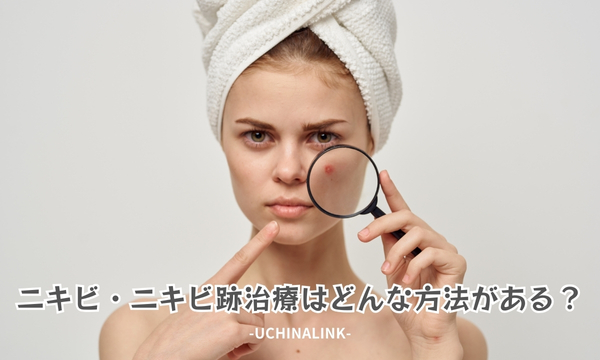 ニキビ・ニキビ跡治療はどんな方法がある?
