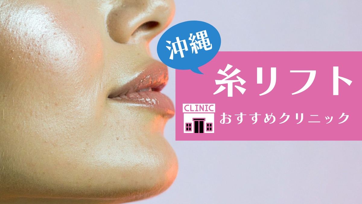 沖縄で糸リフトが安い人気のおすすめクリニックを紹介！
