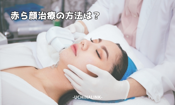 赤ら顔治療の方法は？