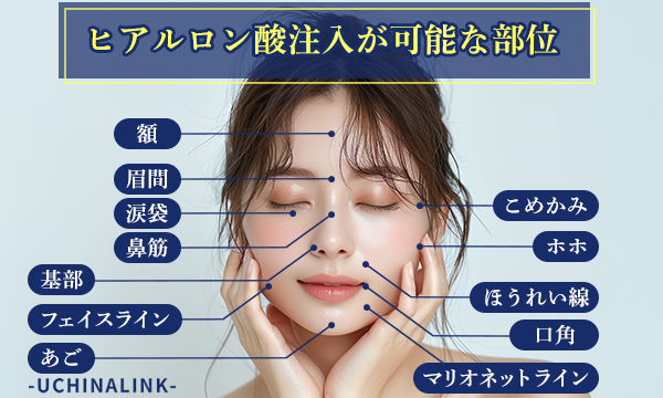 ヒアルロン酸注射が可能な部位