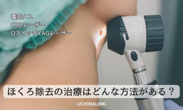 ほくろ除去の治療はどんな方法がある?