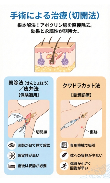 手術による治療（切開法）