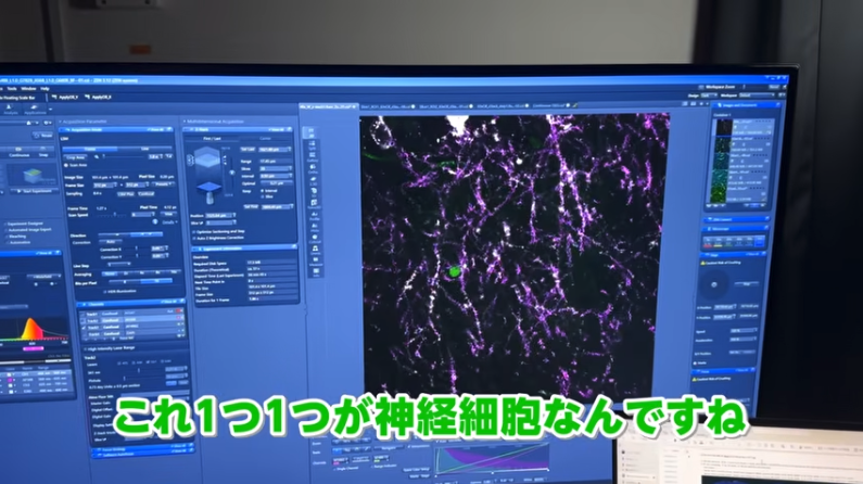 神経細胞を顕微鏡でみる